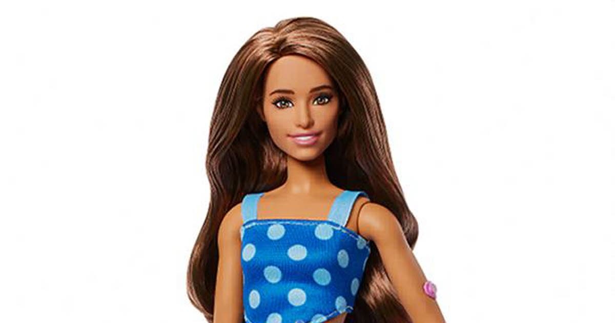 Sociedade. “Tornando a brincadeira mais inclusiva”: Mattel apresenta sua primeira Barbie com diabetes
