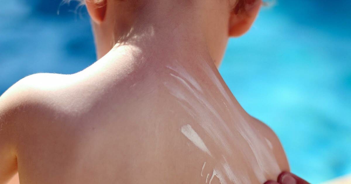 Gesundheit. „Schutz ist das ganze Jahr über“: Kinder bleiben schlecht vor der Sonne geschützt