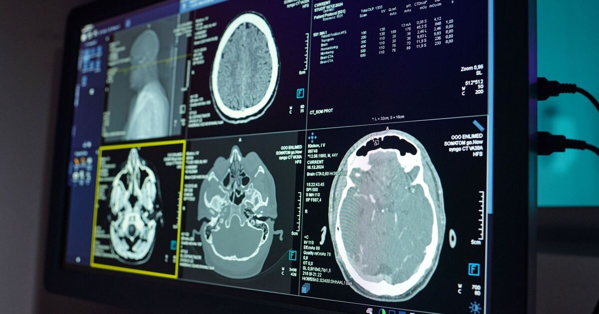 Alzheimer-Studie liefert überraschende Ergebnisse gegenüber geselligeren Menschen