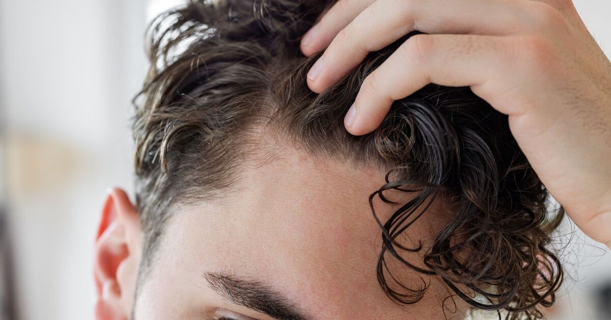 Il medico afferma che l'effetto collaterale della caduta dei capelli di Mounjaro potrebbe essere prevenibile