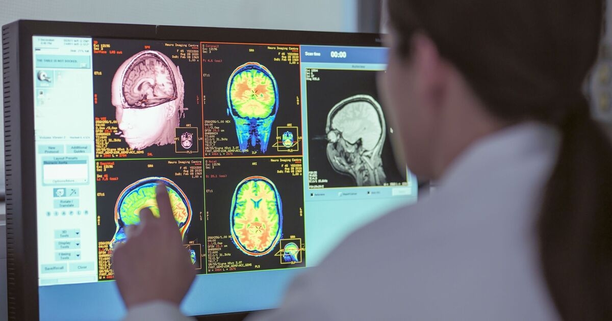Dwa leki przeciwnowotworowe mogą odwrócić zmiany w mózgu wywołane chorobą Alzheimera — pełne wyjaśnienie badania