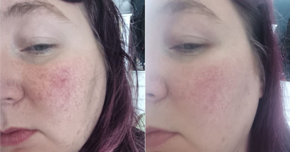 I tried cream that promised to reduce redness — it actually did something else