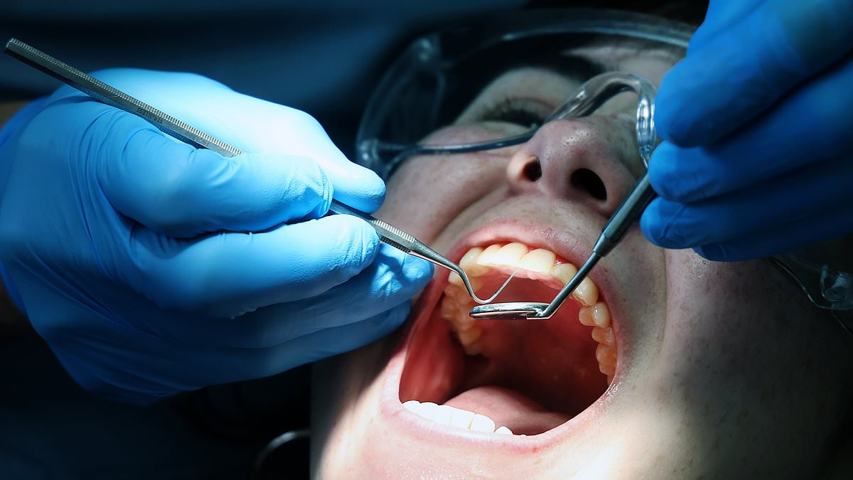 Los líderes médicos advierten que los británicos que necesitan tratamiento dental urgente podrían verse obligados a recurrir a soluciones de la "era Victoriana", mientras 2,2 millones de personas esperan atención