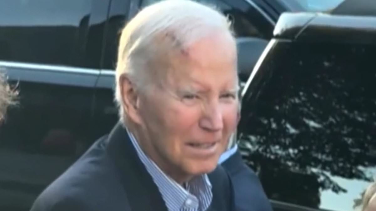 ¿Qué es la cirugía de Mohs? La técnica precisa utilizada para extirpar el cáncer de piel de Joe Biden.