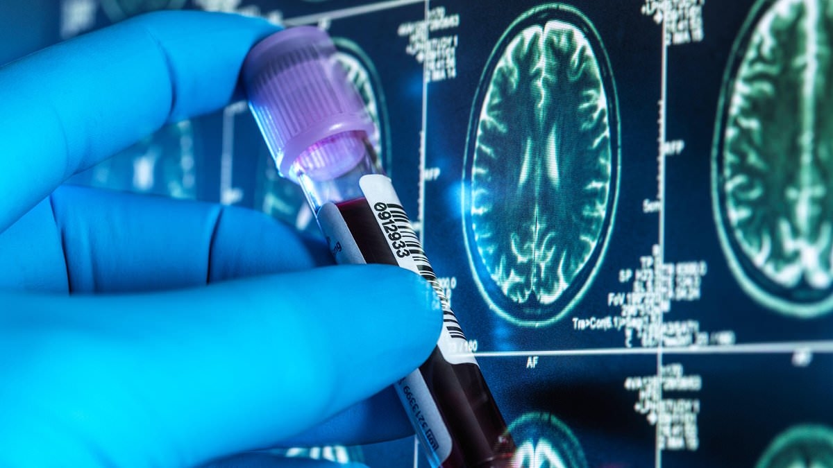 Milhares de britânicos receberão exames de sangue baratos para Alzheimer em estudo histórico
