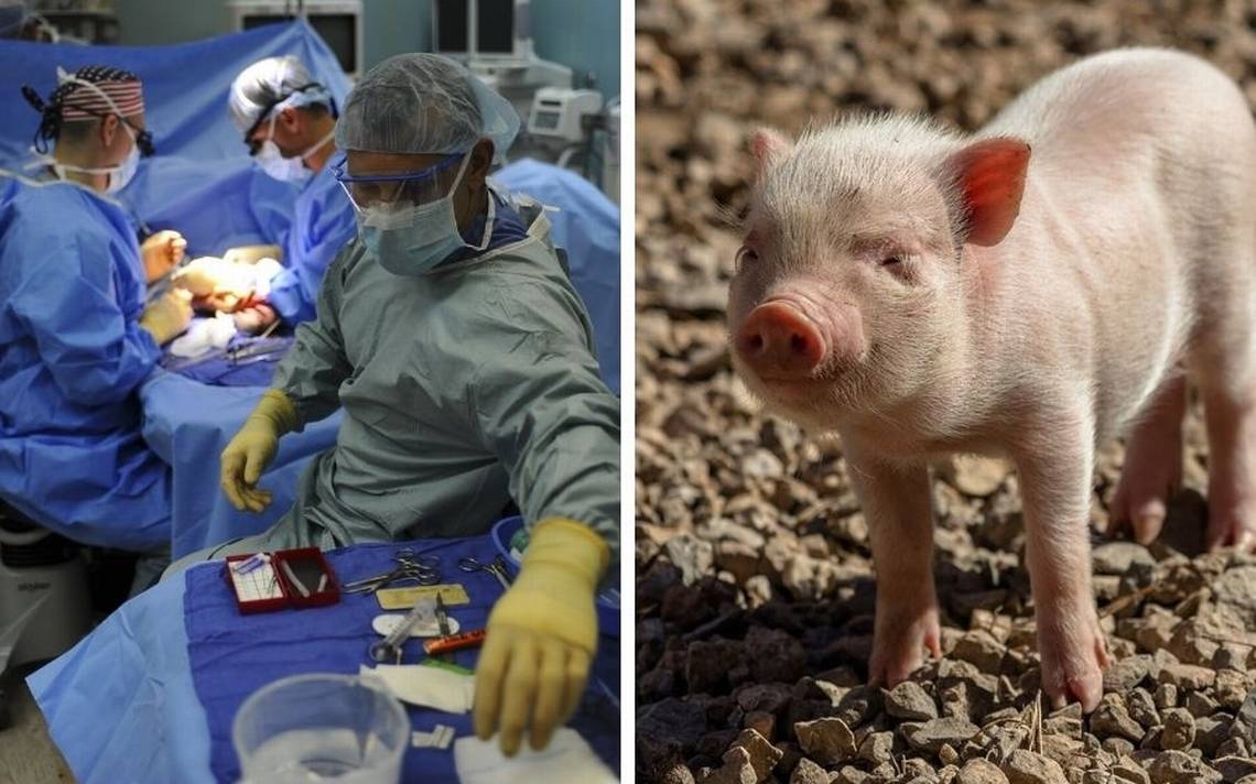 China performs first pig-to-human lung transplant after brain death