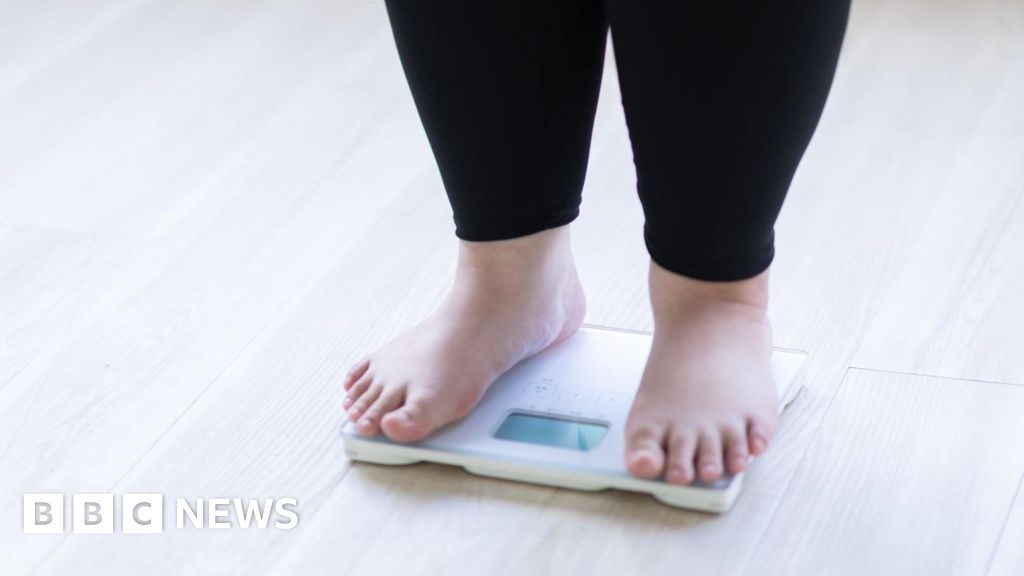 Kliniki zajmujące się otyłością dziecięcą, w których BMI przekracza 50