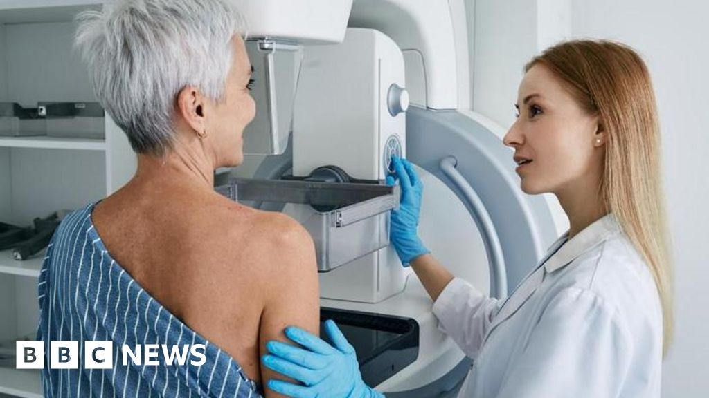 Le donne con seni densi dovrebbero sottoporsi a scansioni oncologiche aggiuntive da parte del Servizio Sanitario Nazionale, affermano i ricercatori