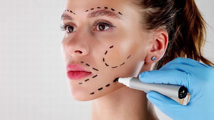 Social media has changed the perception of beauty! Don't make these mistakes when getting plastic surgery