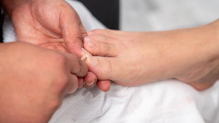 Es geht nicht nur um Ästhetik, sondern auch um Gesundheit! Regelmäßige Nagelpflege verbessert die Lebensqualität.