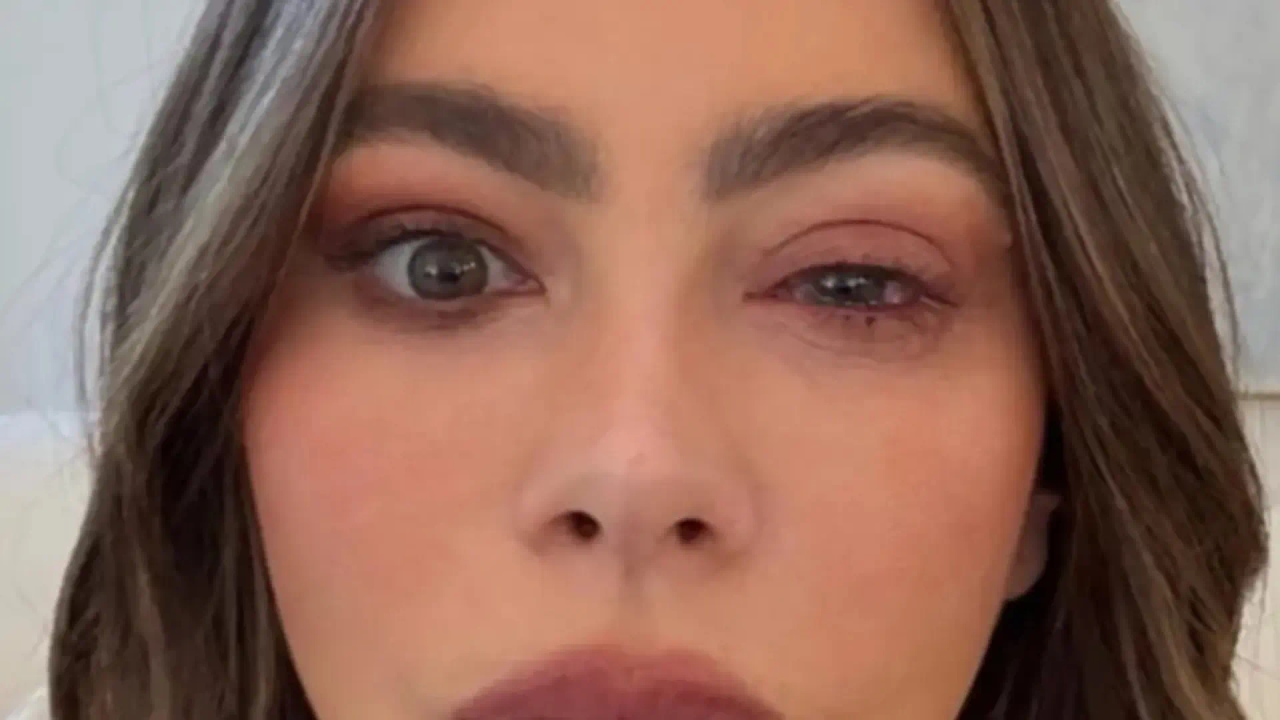 "It could permanently take away vision": Sofía Vergara's eye allergy, explained by an ophthalmologist.