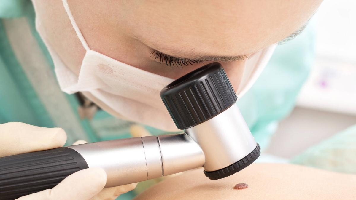 Skin cancer diagnoses have increased by 37% in Bogotá: 'Some people may have it and don't know it'