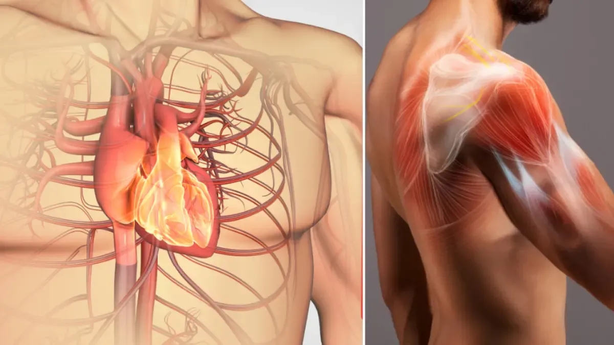 A gordura que se acumula entre os músculos pode ser um novo inimigo silencioso da saúde cardiovascular, de acordo com um novo estudo.
