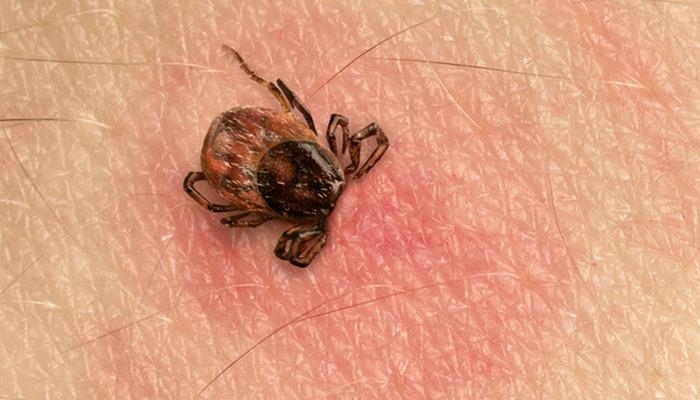 Serious increase in tick bite cases! They live by sucking blood for 15 days: "They are animals that can multiply very quickly"