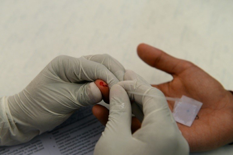 DoxiPEP : comprendre ce qu'est la « pilule du lendemain » contre la syphilis