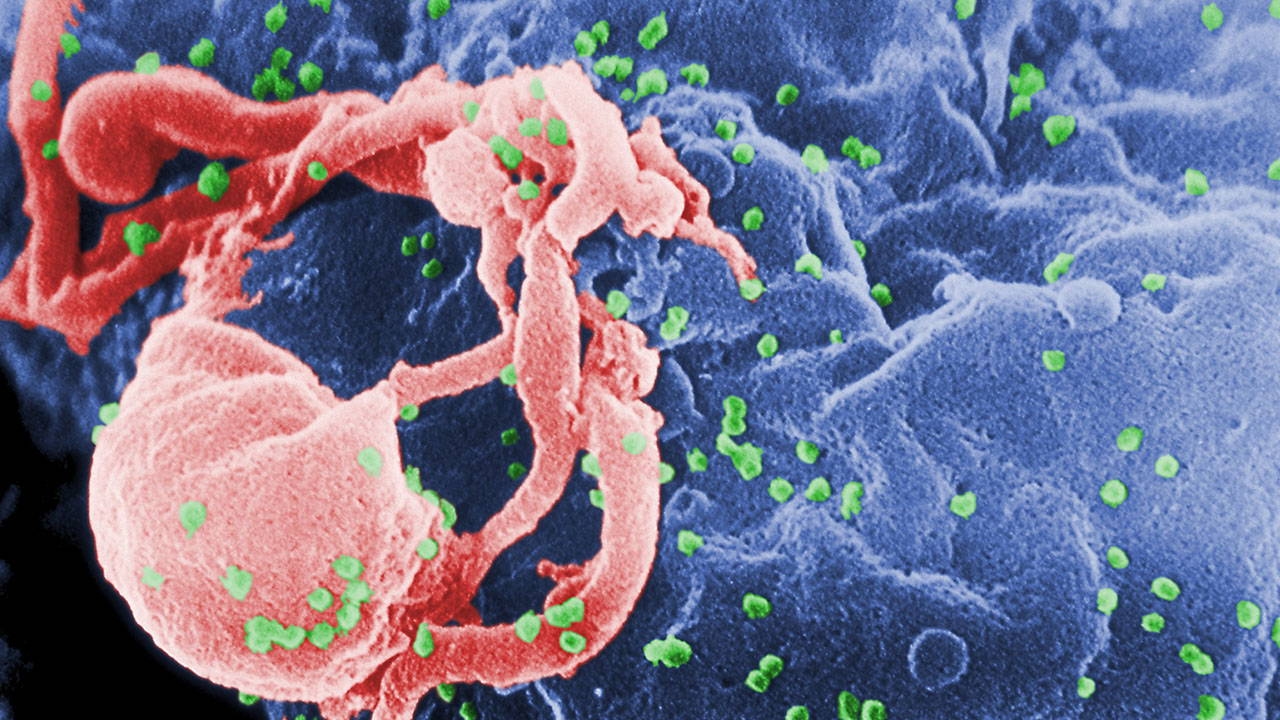 A study conducted in Türkiye found that 1 in 3 people living with HIV had syphilis.