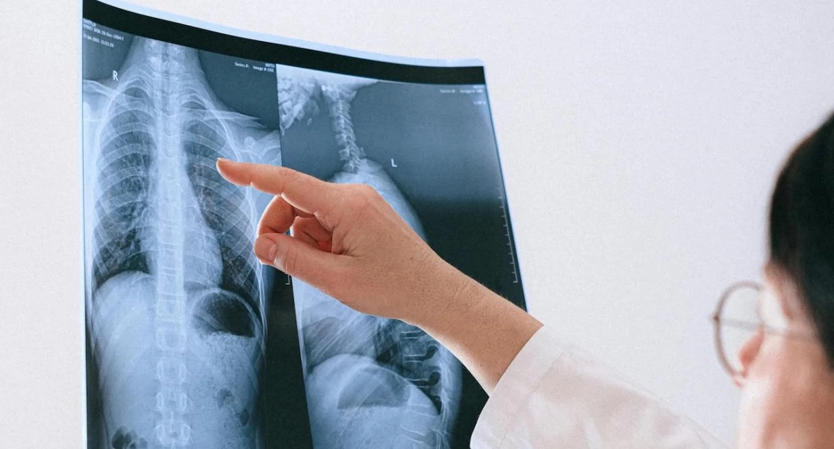 Diagnostyka onkologiczna nadal w tyle. Eksperci alarmują: pacjenci czekają za długo
