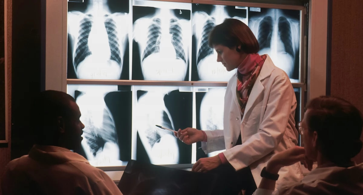 Waarom kankerimmunotherapie niet voor alle patiënten werkt? Wetenschappers ontdekken ontbrekend puzzelstukje