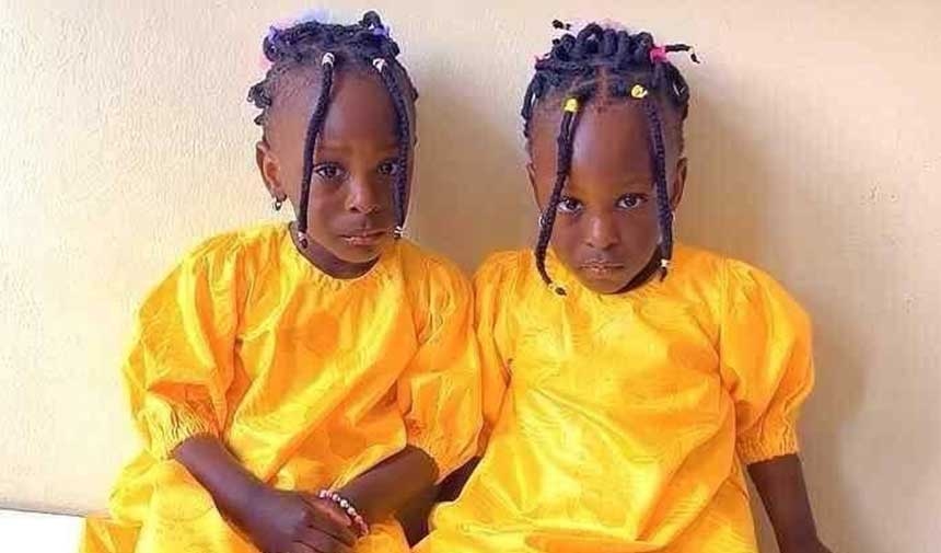 Um 'carro de casamento' separou gêmeos guineenses em Fatih