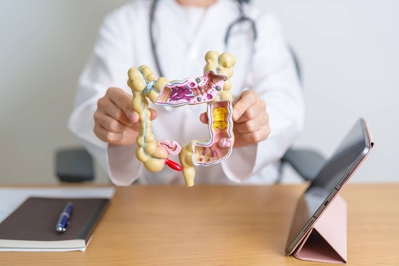 Rak jelita grubego: Mikrobiom może przewidywać ryzyko i pomagać w postawieniu wczesnej diagnozy.