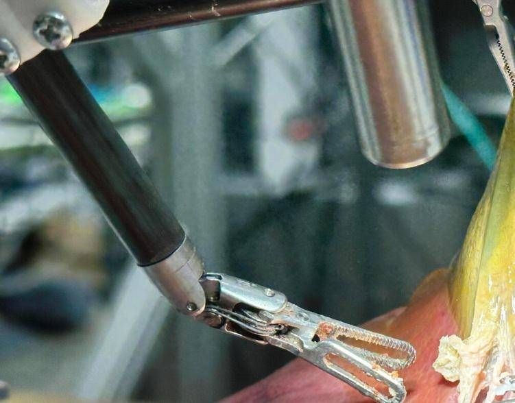 O 'médico robô' opera sozinho, a primeira cirurgia sem assistência humana.