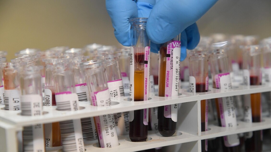 Tumors, test tells in advance who does not respond to chemotherapy