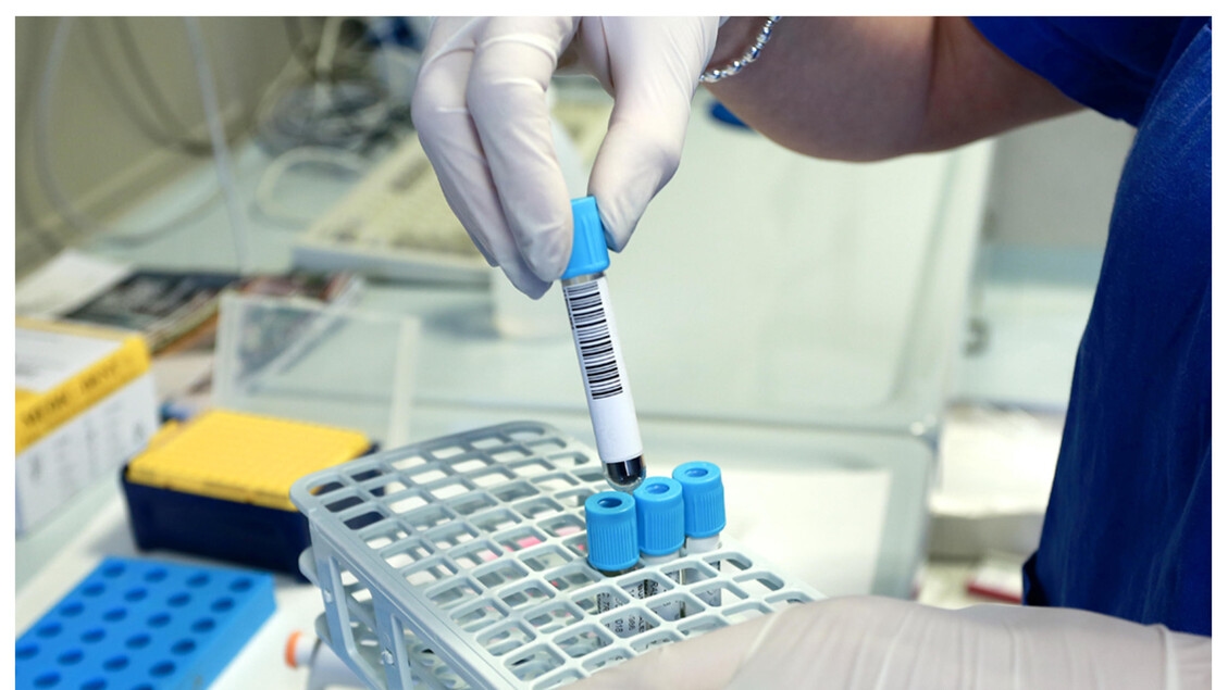 Rare diseases: 100 projects submitted for AIFA's independent research call