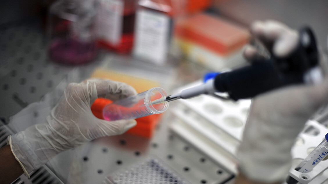 VIH et « codes » immunitaires identifiés pour la suspension du traitement