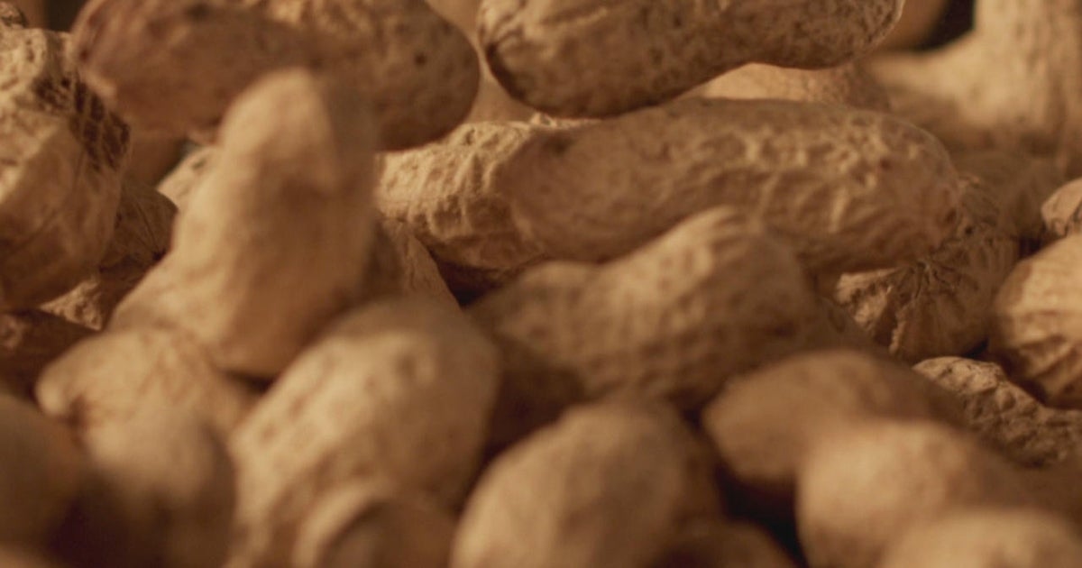 Some 60,000 kids have avoided peanut allergies due to 2015 advice, study finds