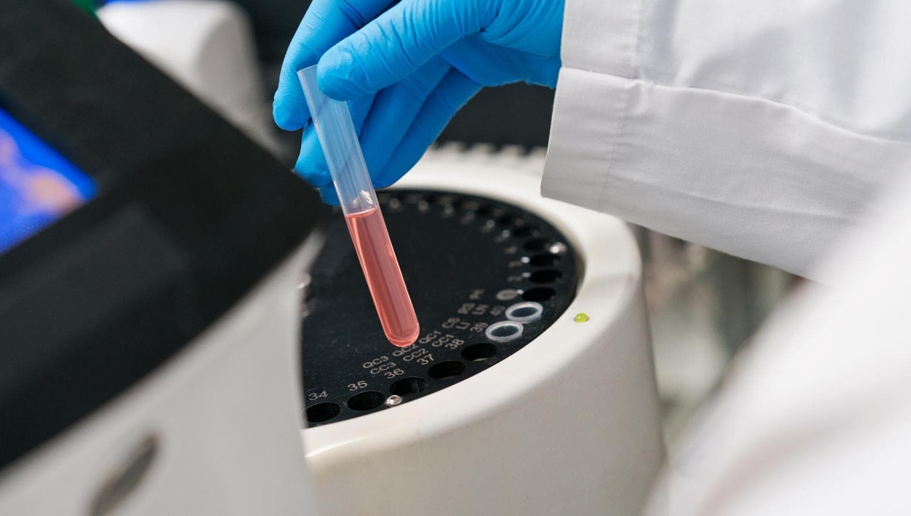 Infarto, arriva il “tritest”: con tre esami del sangue sapremo chi è a maggior rischio